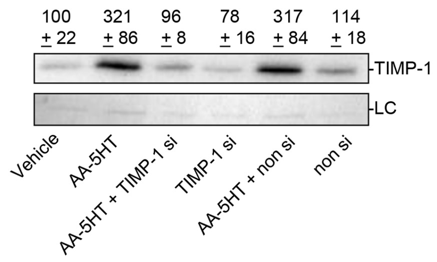 Concentration-dependent effect of FAAH inhibitors on TIMP-1 protein levels.jpg